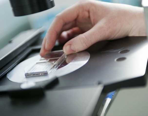 SAMe或成慢性结肠炎新希望？